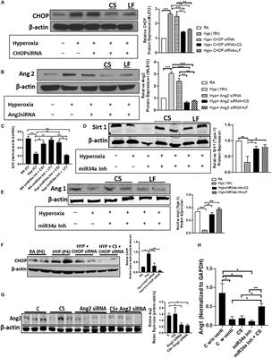 Small Molecule Inhibitor Adjuvant Surfactant Therapy Attenuates Ventilator- and Hyperoxia-Induced Lung Injury in Preterm Rabbits